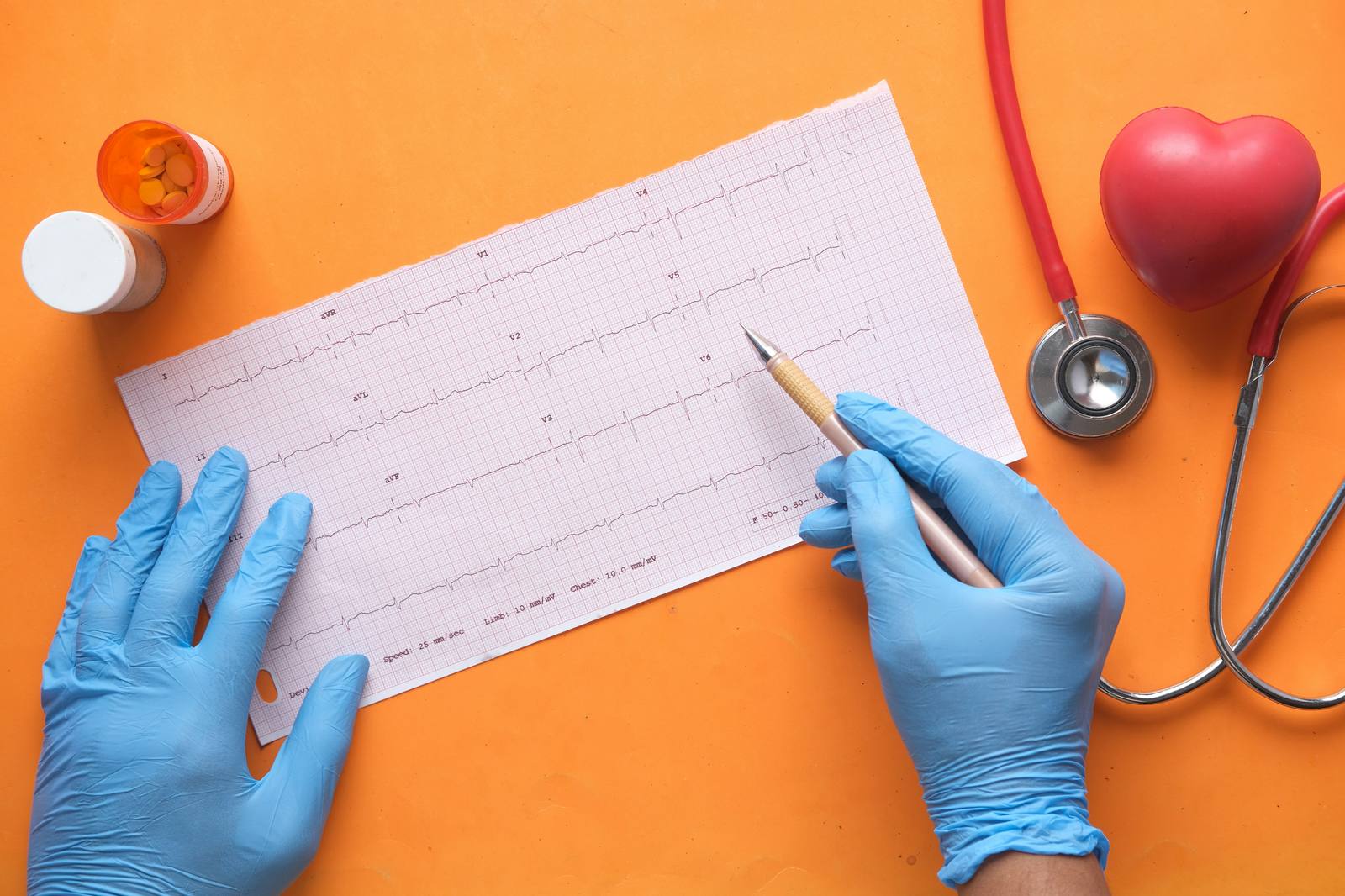 Kardiologie Mönchengladbach